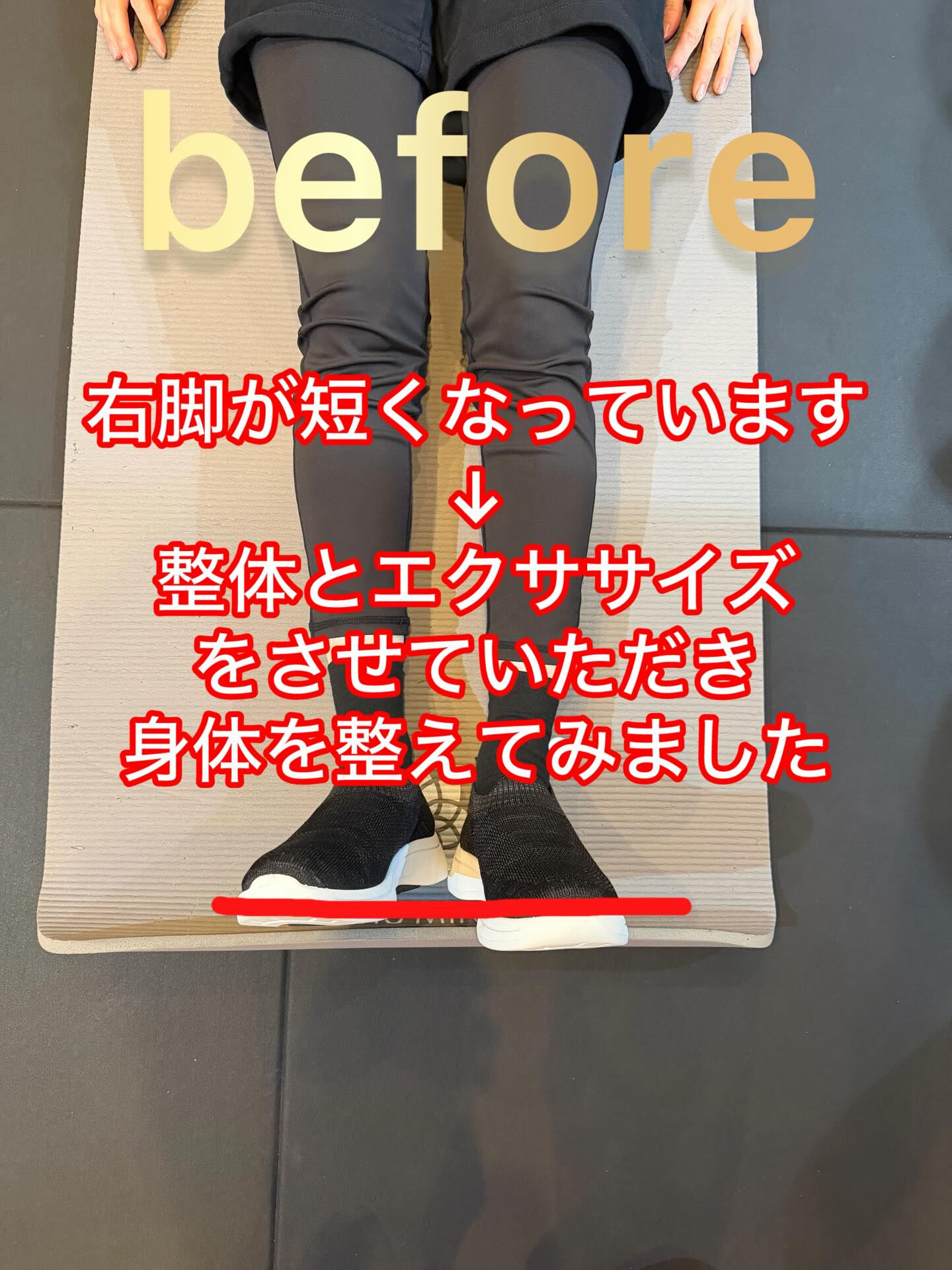 右膝に違和感のある方